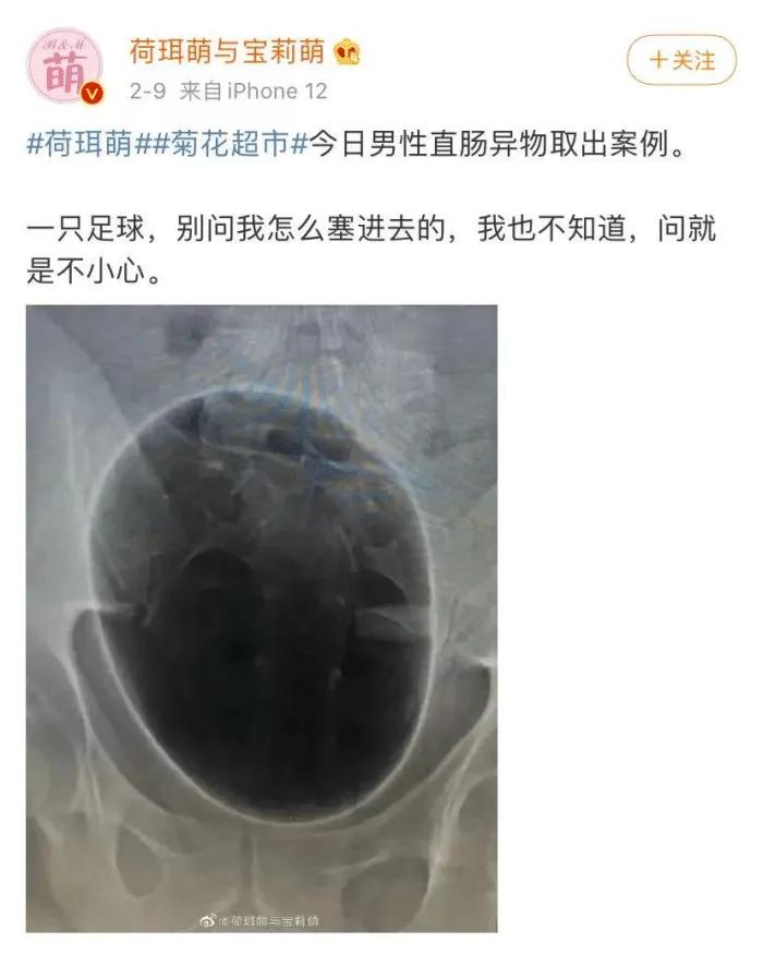 菊花塞足球，人体的极限到底有多大？