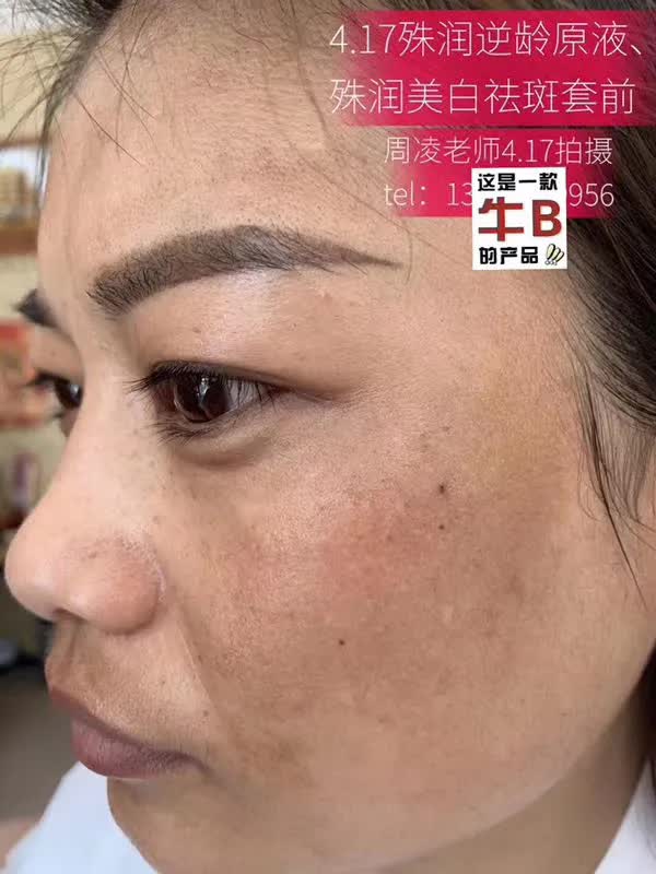 推荐好用的祛斑套盒,祛斑套盒推荐测评