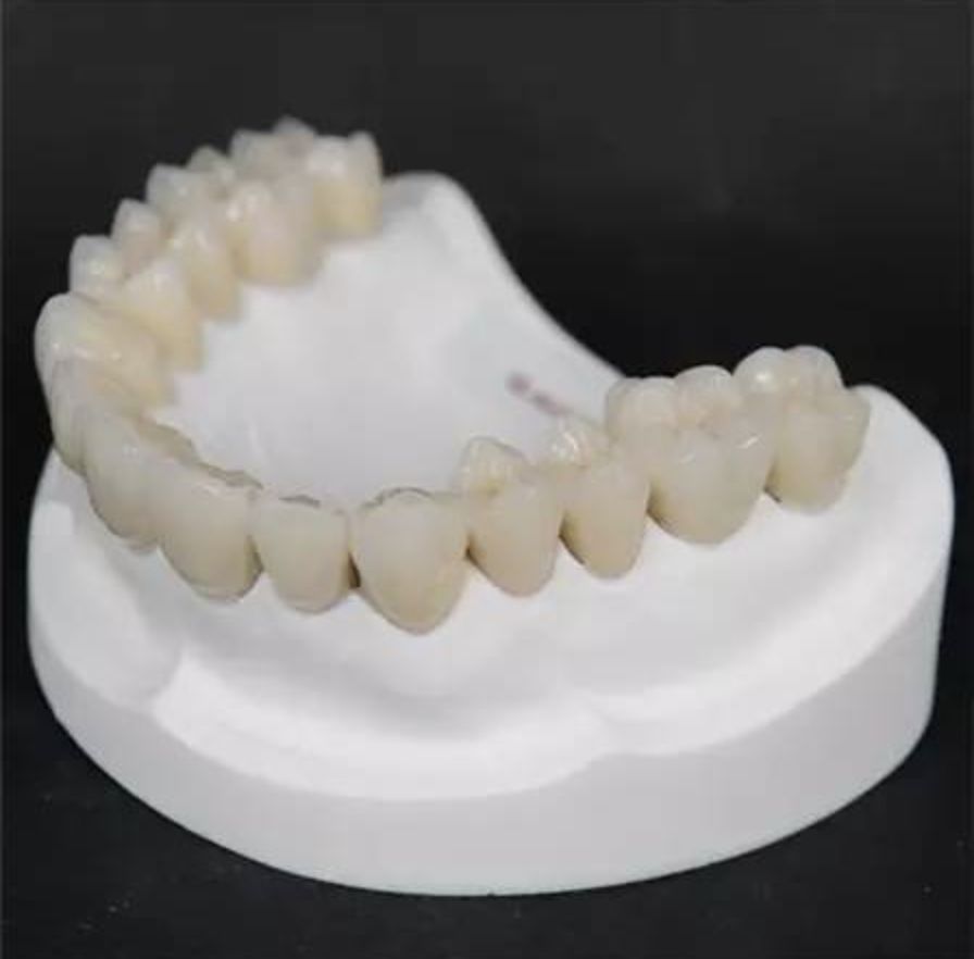 烤瓷牙与全瓷牙价格大全,全瓷牙与烤瓷牙价格差多少