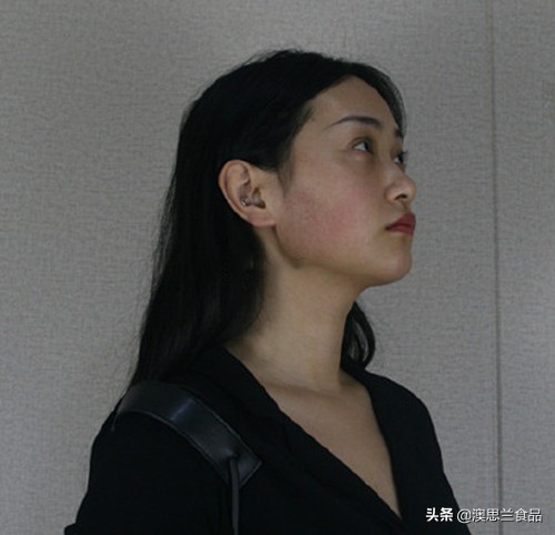 脸大瘦脸最快的方法,肉肉脸瘦脸的方法