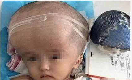 当年喝三鹿奶粉的孩子现在怎样了,当年喝三鹿奶粉的孩子怎么样了