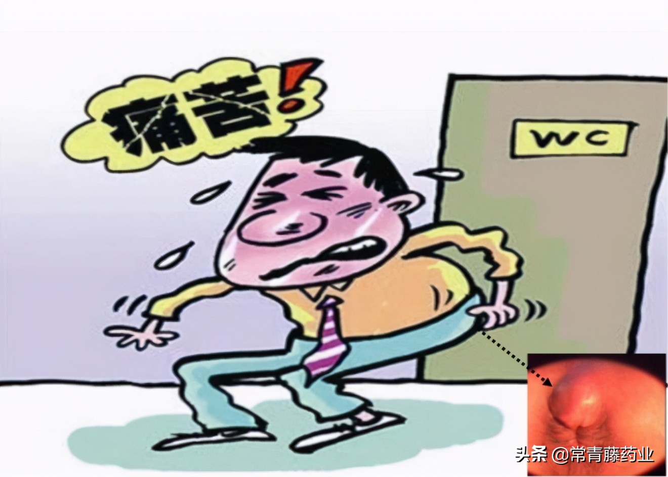 肛门脓肿引流了以后怎么治疗,肛门脓肿破脓后治疗方法