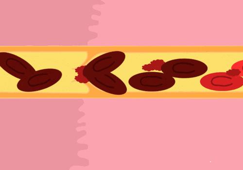 肾虚体寒喝什么,肾虚体寒需要治疗吗