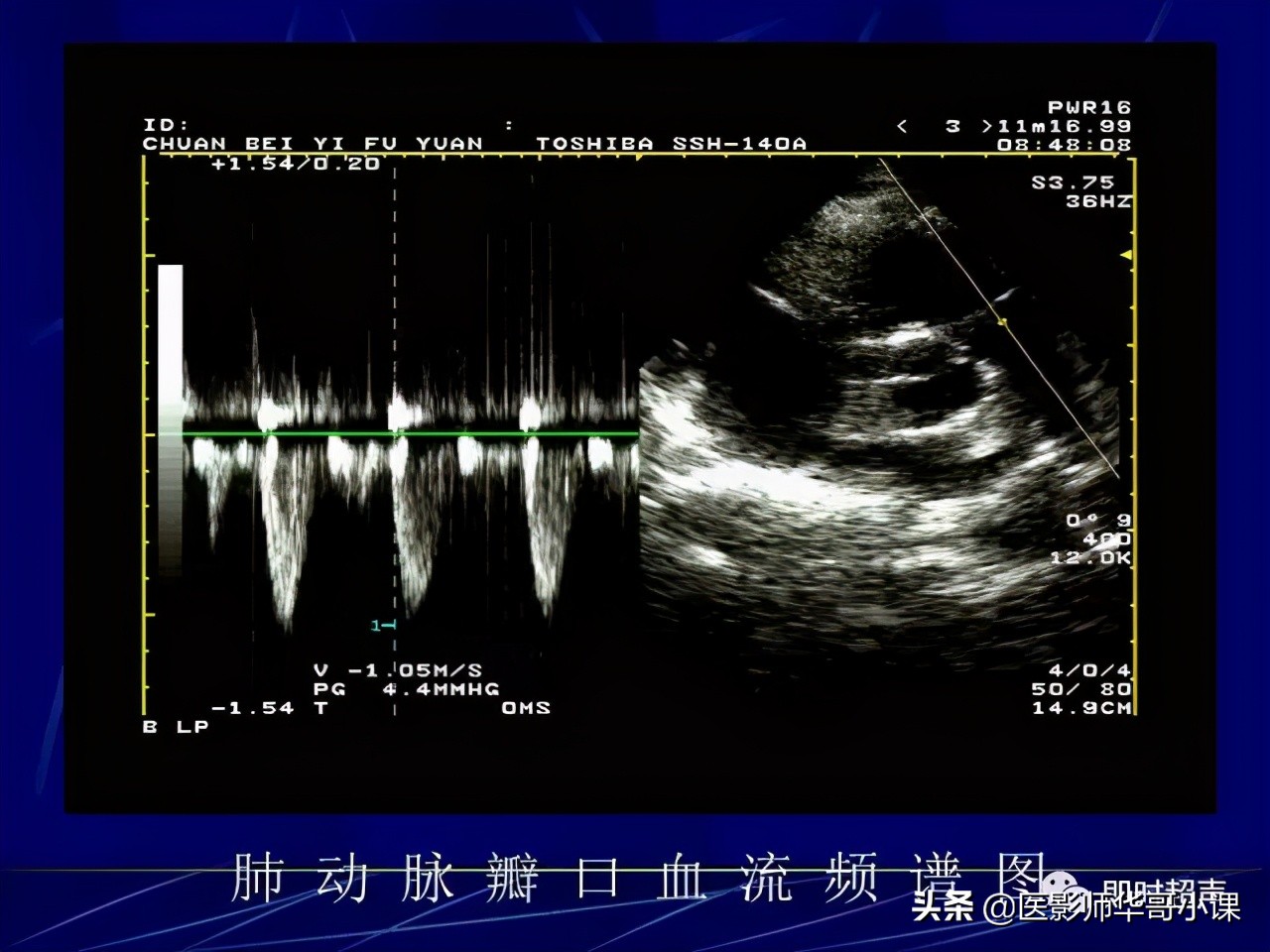 超声检查报告单讲解,超声图像检查