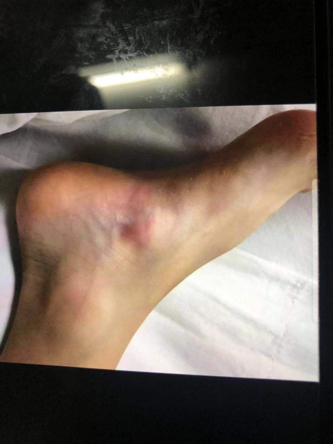 7岁男孩习武被教练击死,7岁男童武校身亡涉事教练被判6年