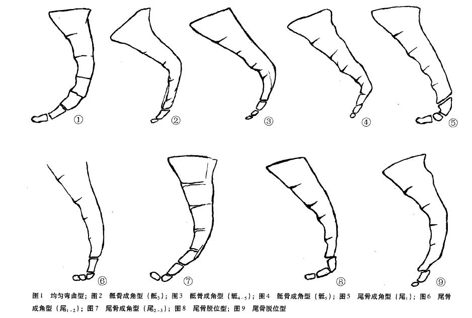 女性尾骨痛到无法翻身起身,女性尾骨疼痛时坐时疼是什么原因
