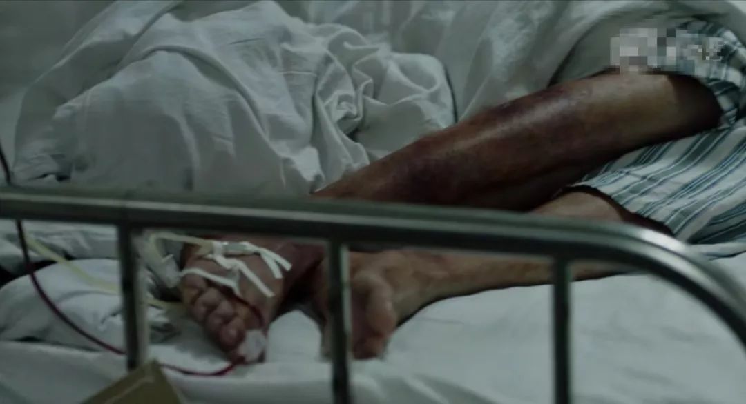 治愈白血病的药神,白血病特效药290元