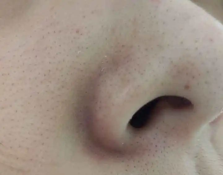 宋威龙对赵露思的评价,宋威龙痘痘肌