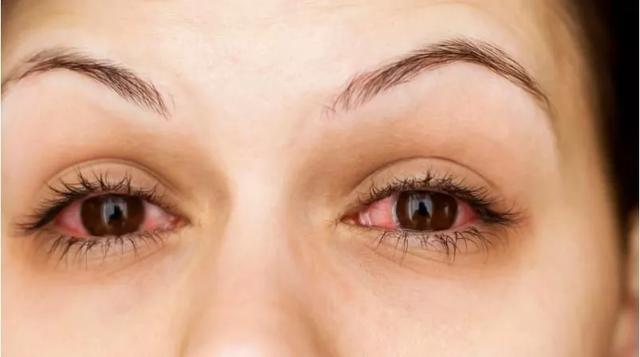 真实好用的睫毛增长液,日本睫毛增长液