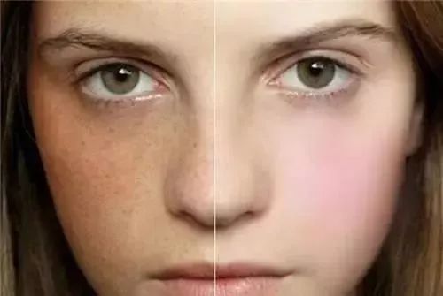 鼻子长痘是胃不好吗,鼻子长痘是肝火还是胃火