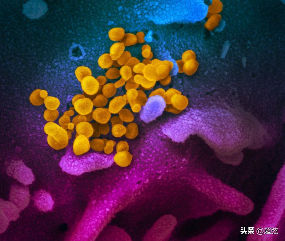 治疗好的冠状病毒会二次感染吗,治好的新型冠状病毒还会被传染吗
