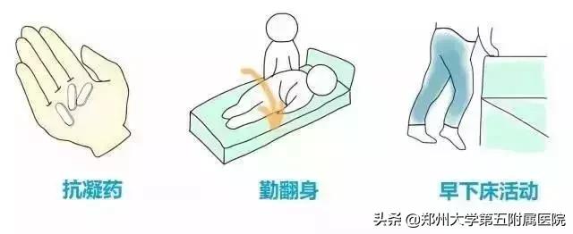 孕期下肢静脉血栓孩子真不能要吗,孕期下肢血栓的症状有哪些