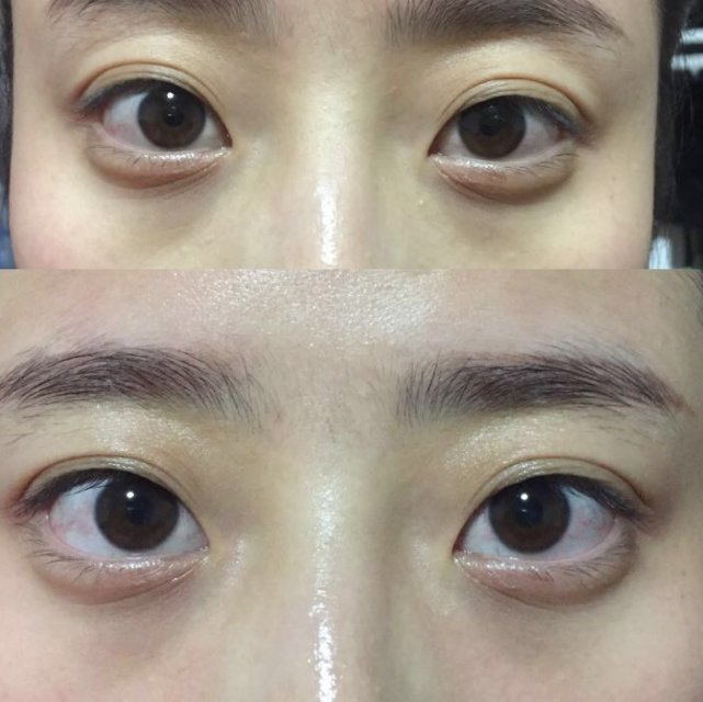 资生堂抗皱眼膜正确使用方法,日本晓姿眼膜能去除细纹吗