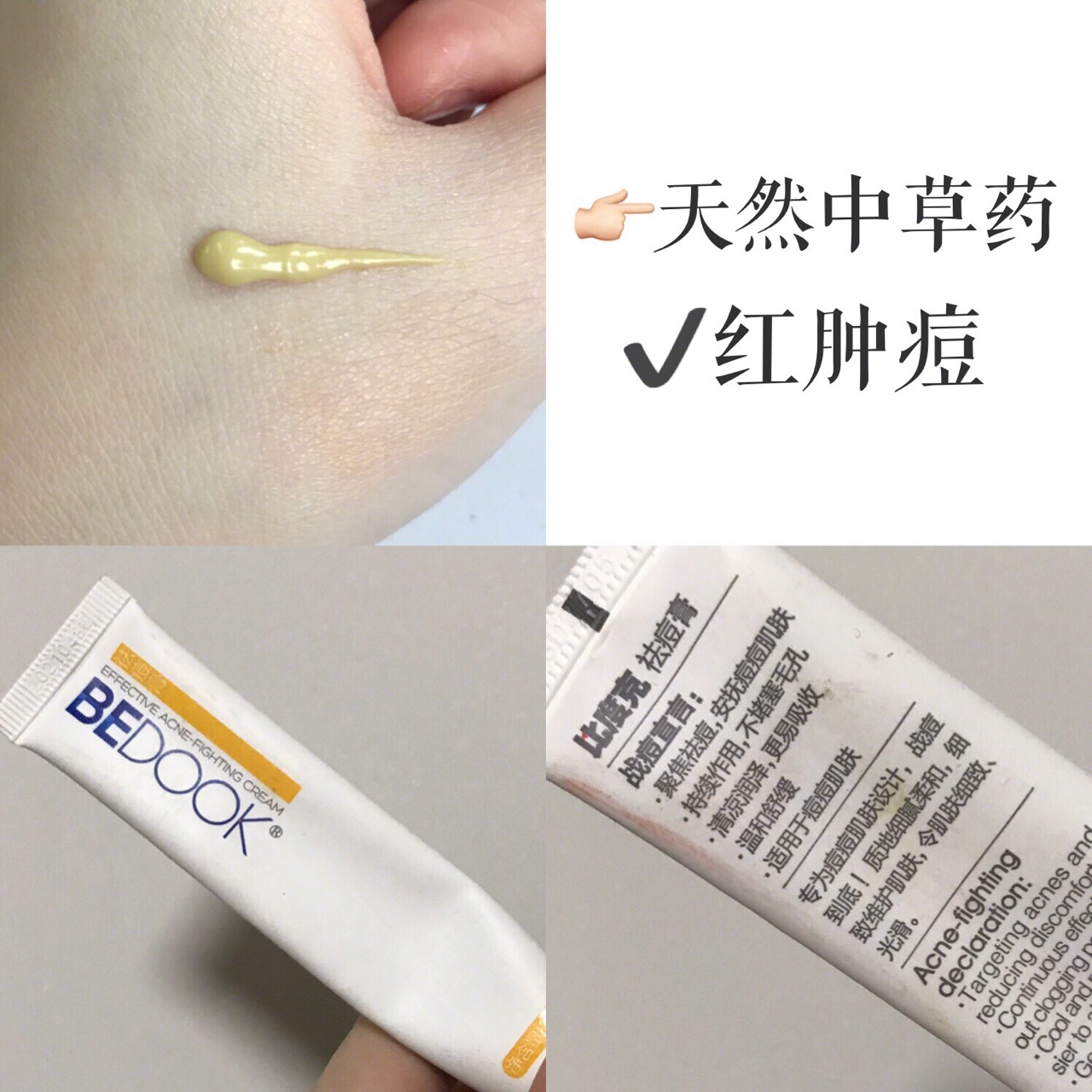 网上卖的十大祛痘药,女孩子必用的祛痘神器