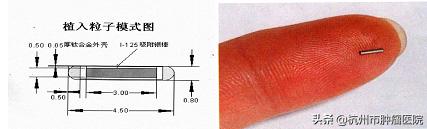 肿瘤医院ct三维重建图像多少钱,医院3d打印肿瘤模型