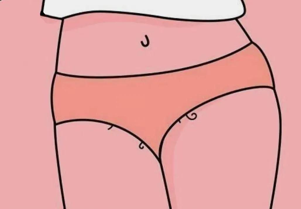 屁屁中间毛太多，也可能是病吗？