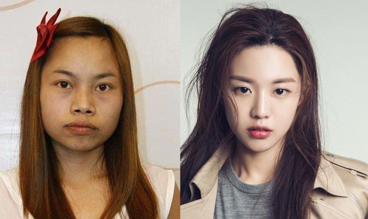 哪些情况下不适合整形,什么整形手术最容易失败