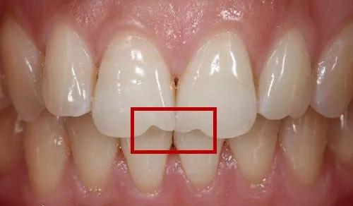 炎黄子孙四大印记,炎黄子孙最为显著的标志