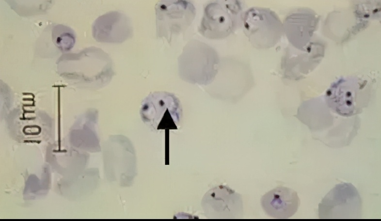 检查身体有没有虫怎么检查,身上有小黑点点一样的虫子