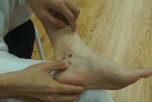 痛经布洛芬吃多了有什么危害啊,布洛芬是不是止痛药治不治痛经