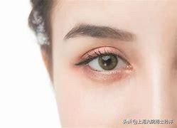 开眼角不对称可以免费修复吗,做开眼角后用什么祛疤