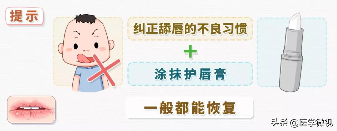 嘴唇干裂起皮反反复复,嘴唇一年四季干燥起皮是什么原因
