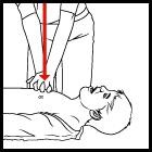 学习心肺复苏操作完整版,急救心肺复苏的7个操作方法