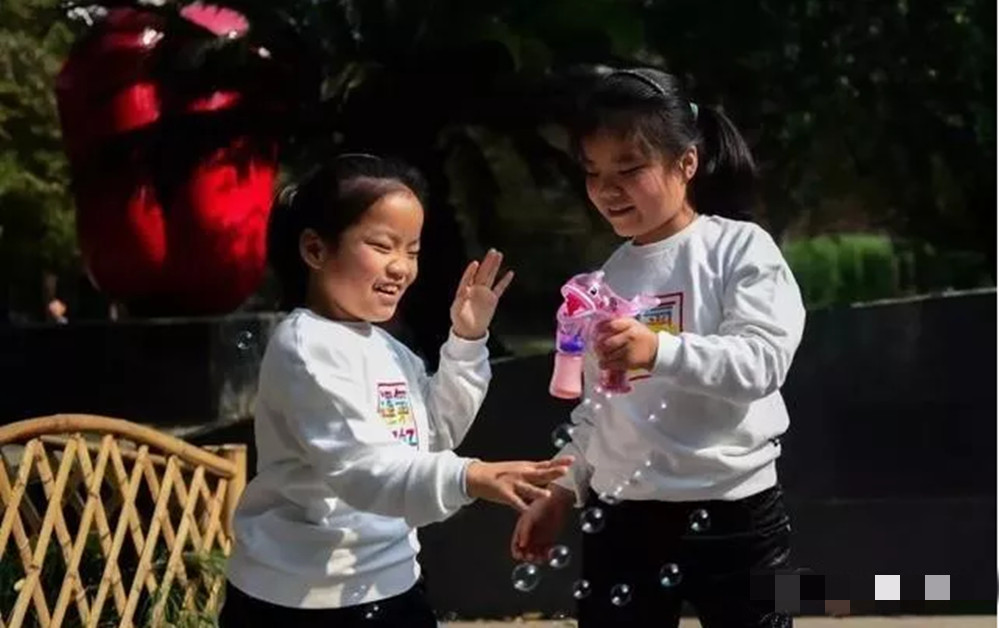 双胞胎坐骨连体成功案例,坐骨连体姐妹分离成功了吗