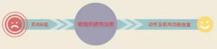 跑步放松肌肉方法筋膜枪,找到你科技是什么软件