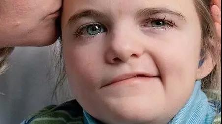 如何拯救面瘫脸无表情,如何才能拯救我的脸