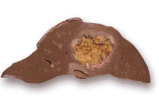 组织切片常见问题,组织切片的制作过程以及常见问题