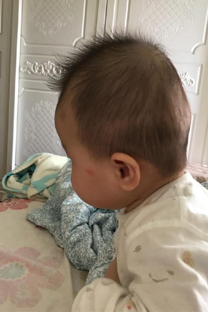 纠正宝宝偏头睡觉的小妙招,如何防止宝宝睡偏头及补救方法