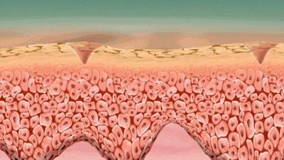 一张嘴臭牙齿就臭怎么办,一张嘴就口臭小妙招