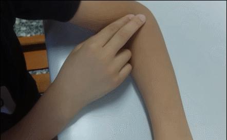 网球肘能自我恢复吗,网球肘病因的解剖学研究