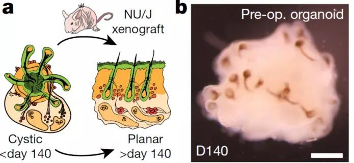 脱发治愈研究,困扰当代年轻人的脱发