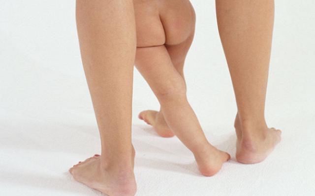 宝宝的腿纹一边多一边少正常吗,宝宝的腿纹必须一样吗