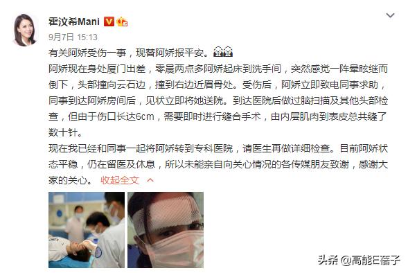 阿娇额头伤口恢复过程,阿娇晒伤口恢复照