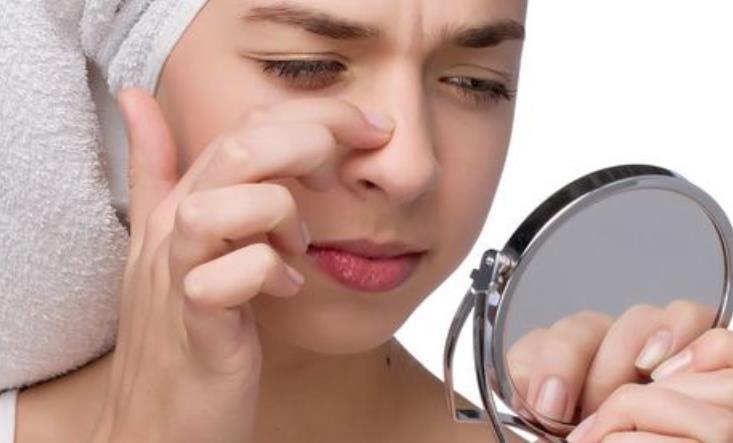 去黑头去粉刺去螨虫干货,去黑头和螨虫的最好方法