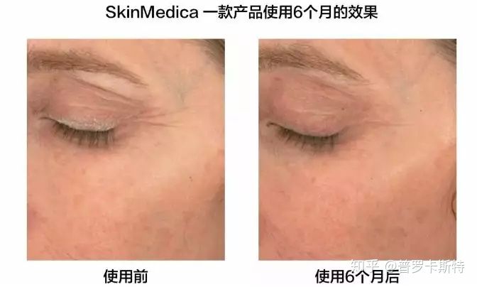 冻干精华第一名,一支冻干粉6瓶精华液