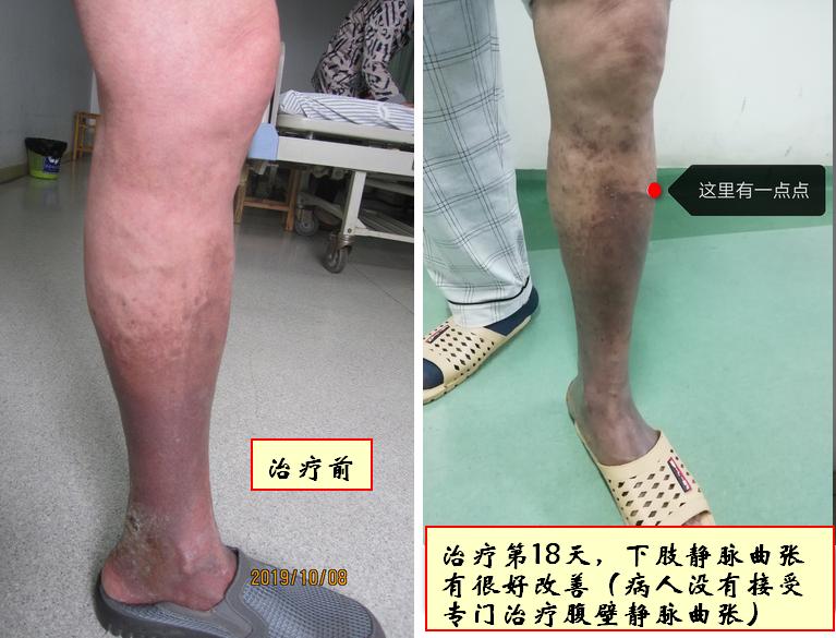 小小外伤4年8次住院，三甲医生举案说法：健康无小伤，手术须慎行