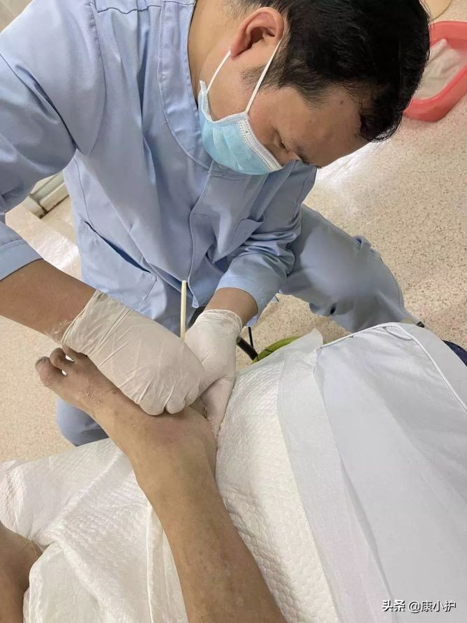 即使手指已弯曲变形，患者仍努力尝试为泰心康护护理员竖起拇指