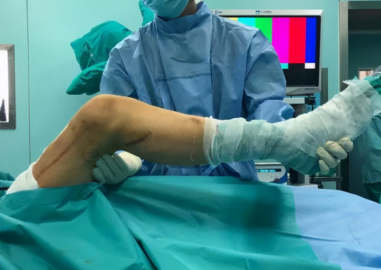 膝关节僵硬用关节镜松解,关节镜术后膝关节僵硬