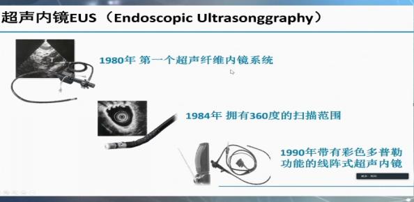 上消化道内镜检查常规流程图谱,消化内镜检查流程及注意事项