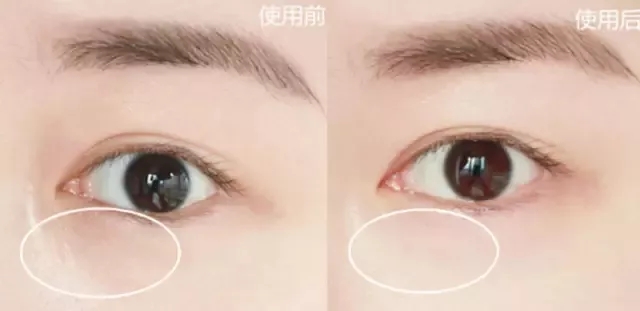 公认最好用的平价眼霜十大排行,最好用的十大平价眼霜排名