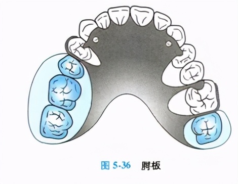 牙列缺损的可摘局部义齿修复题库,牙科美学修复精讲