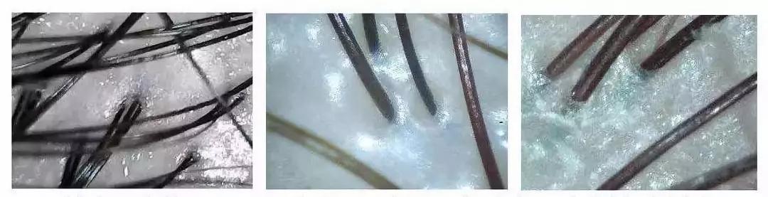 明星亲测力推同款洗发水,康王亲测