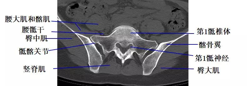 颈椎腰椎疾病ct及mri诊断,腰椎ct可以发现肠部病变吗