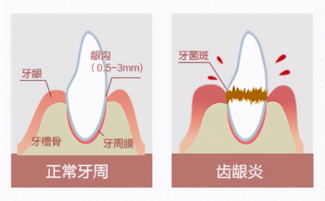 看着是个小可爱，本领可不小：罗曼W10小宝塔冲牙器试用体验