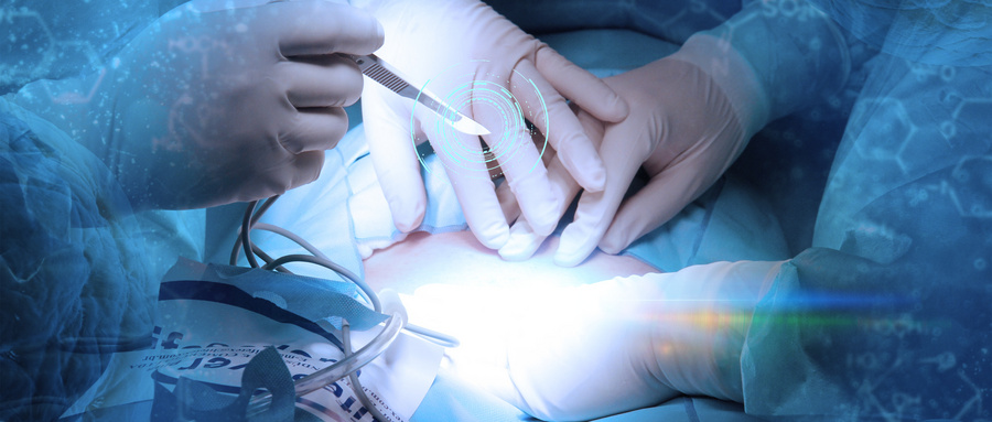 丁丁假体的一般知识