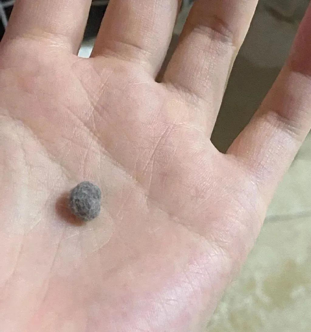 网友晒出5颗巨型毛球，救命！我快要窒息了